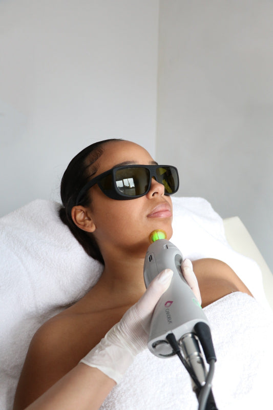 Laserontharen met een laser vs IPL?