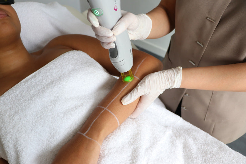 De 5 voordelen van de GentleMax Pro laser