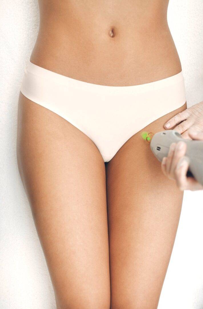 Hoe ontstaan scheerirritaties rondom de bikinilijn?