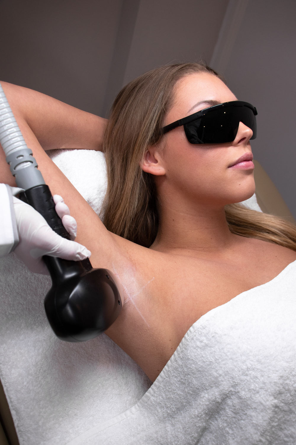 Laserontharen bij Eunoía Clinic